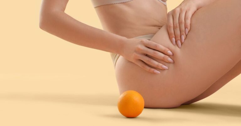 Целулит: победете „портокаловата кожа“ с помощта на колаген