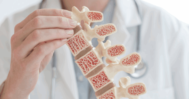 Остеопороза: всичко, което трябва да знаете