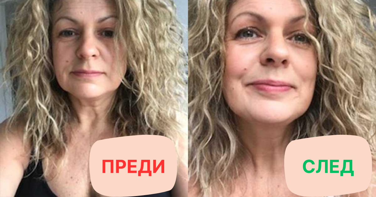 Преди и след продуктите на Voonka